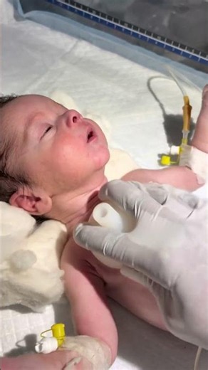 Chestryped for newborn baby😌 #sumitnicunursingstm #youtubeshorts #nursin #newbornbaby #chestworkout