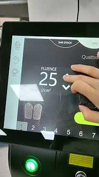 Diode Laser (Soprano Titanium)