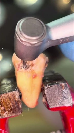 Real Tooth Drilling in Extreme Macro #dentalcare #satisfying #satisfying #dentalartistry