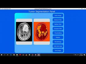 Brain tumor Segmentation using Python and openCV- PyQt GUI interface