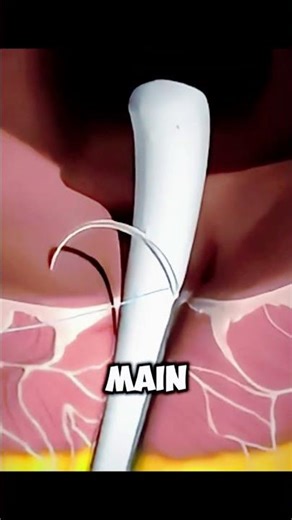 How Fistula Repair Surgery Heals Infections | 3D Medical Animation Explained #facts #science