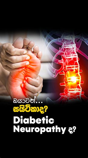 23K views · 152 reactions | ඔයාටත් සයිටිකාද? Diabetic Neuropathy ද?...