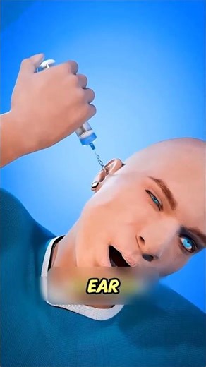 What if a cockroach crawls into your ear 🪳👂