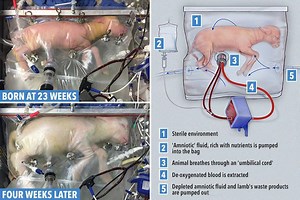 Pioneering 'artificial' womb could save thousands of premature babies