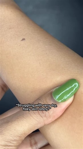 Dr Aditi Choche on Instagram: "Dry skin comfort 🤍 Soft, calm, glowing skin ✨ @timelessbeautysecrets.angels (Code ADITITBS10 if you want it)"