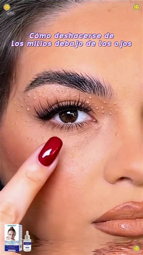 Quick & Painless Milia Removal with Eye Serum
