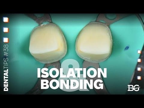 Optimal anterior isolation & bonding