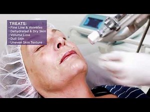Australian Laser & Skin Clinics - V2 Skin Booster Injections