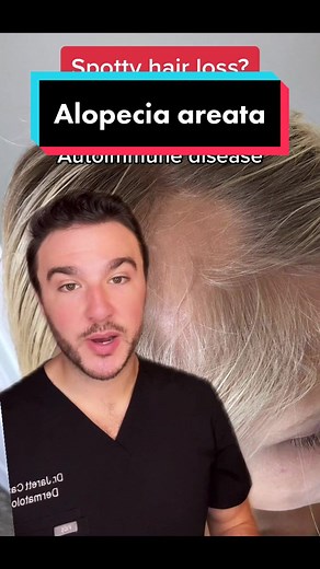 Understanding Alopecia Areata: Steroid Injections for Hair Loss