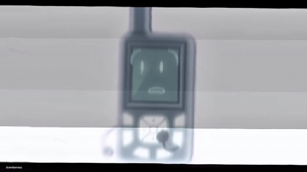 Understanding the Controversy Around TNM6