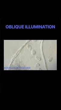 Infusoria Under the Microscope #microscopy #brightfield #darkfield #science