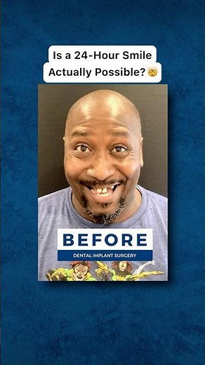 How I Got My New Smile in 24 Hours! 🦷