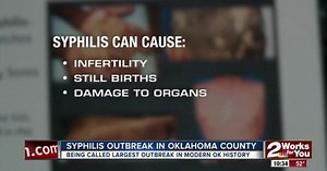 Okla. Co. dealing with large syphilis outbreak