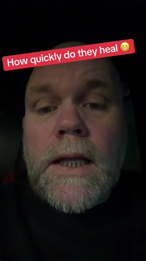 Kim Tate’s Dramatic Hospital Recovery Explained