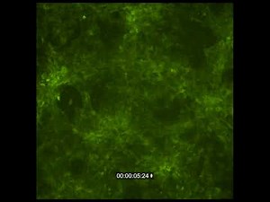 Fluorescent microscope video of cardiac muscle cells