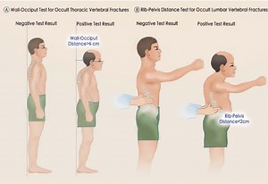Postural Assessment Copy - Bone Fit™