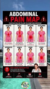 Where Does Your Abdominal Pain Come From? 🩺 | Abdominal Pain Map Explained #Shorts