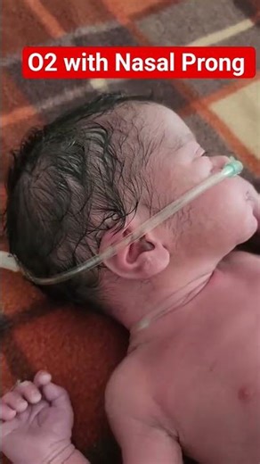 O2 Nasal Prong #nicu #picu #mbbs #icu #hospital #bams #pediatrics #balrog #yt #ytindia #fyp #fb