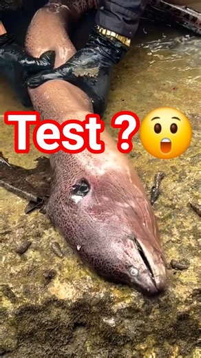 virtual reality vedio Test Result?🤔 #health #medical #students #trend #shots #education #explore