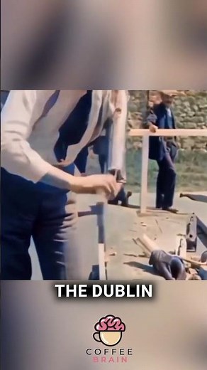 The Dublin Arm revolutionary artificial arm invented in 1921 #viral