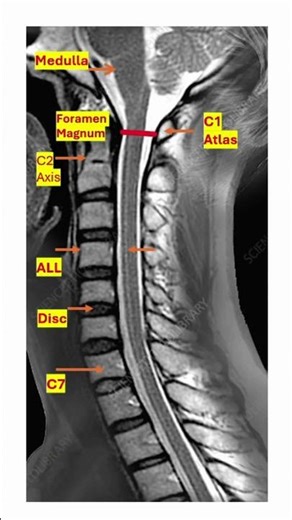 Quick Cervical Spine Anatomy Review MRI Radiology Shorts