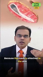 🤔 Do you know Discover how to check the mesh used in your hernia surgery💡#SurgicalAwareness