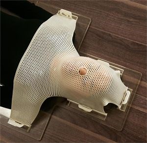 [Hot Item] O-Type-5 Point Head&Shoulder Thermoplastic Mask with 30%/36% Perforation 2.4/2.8/3.2mm for Cancer Oncology Radiation Therapy Immobilization CE ISO13485