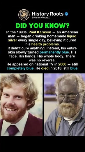 His Skin Turned Blue And Never Went Back #history #facts