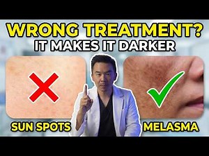 Melasma vs Sun Spots vs Hori's Naevus: Stop Wasting Your Money