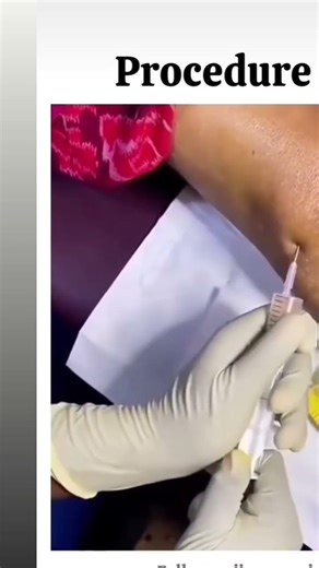 #Nursing knowledge # Nurse # Medicos # Apron beauty.................😍😍😍😍😍