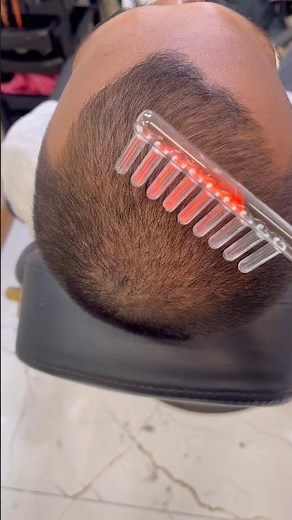 Your Hair Will Never Be the Same After This High Frequency Wand Experiment #HairGrowth #Results