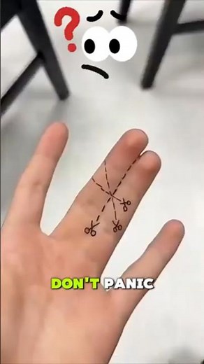 How did these fingers get like this? 🧐😱