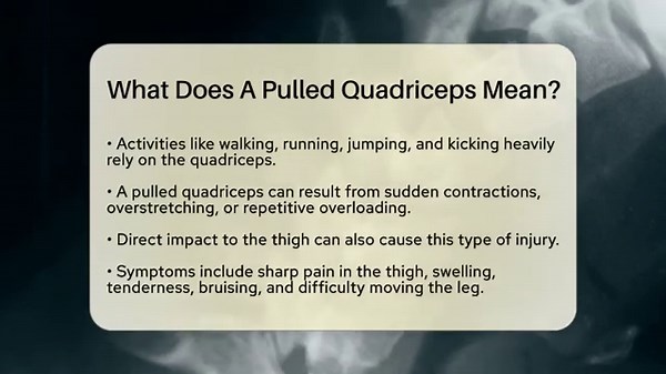 What Does A Pulled Quadriceps Mean? - Orthopedic Support Network