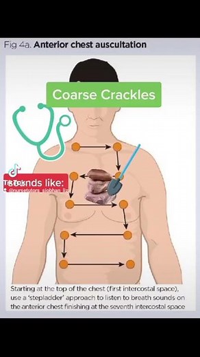 Chest Auscultation- Identifying common Breath/Lung Sounds