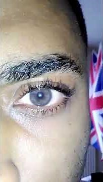 eye color change testimonials 04