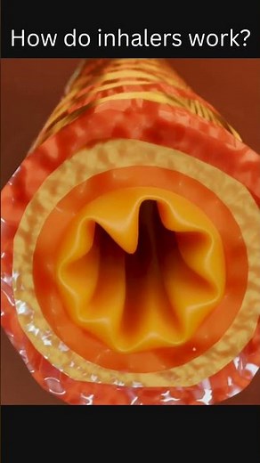 How do inhalers work?.