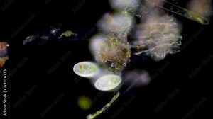 Single cell microbes with beautiful armoured shell, feeding under the microscope. Dark field microscopy.