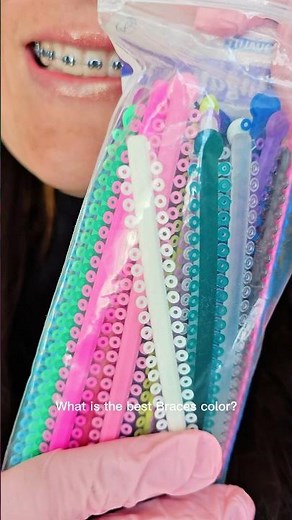 What’s the Best Braces Color??