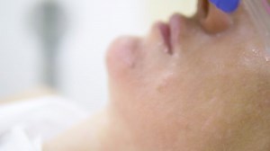 cosmetology concept, face care. woman face during the procedure of jet peeling, facial