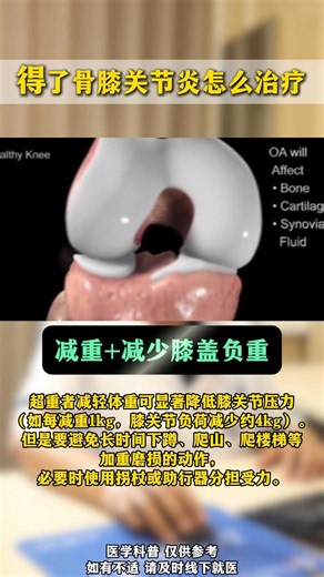 得了骨膝关节炎怎么治疗