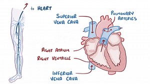 Video: Deep vein thrombosis - Video Explanation! | Osmosis | Osmosis