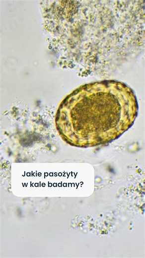 Instytut Mikroekologii | Mikrobiota jelit | SIBO | Probiotyki on Instagram: "Nawracające problemy trawienne, zmęczenie czy wahania apetytu często zrzucamy na stres lub gorszy dzień. Tymczasem ich przyczyną mogą być… pasożyty jelitowe 🫣 Aby dokładnie sprawdzić, czy w jelitach znajdują się pasożyty, w Instytucie Mikroekologii wykonujemy badanie kału pod mikroskopem metodą zagęszczeniową i wspieramy je badaniem metodą immunoenzymatyczną (ELISA) (🔗 link w bio - https://instytut-mikroekologii.pl/pr