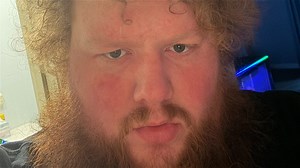 Tragic Details About CaseOh
