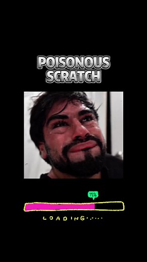 Poisonous Scratch: A Scary Experience in the USA