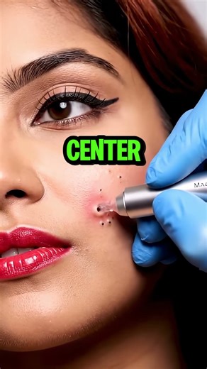 Her Perfect Makeup Was a LIE... Hiding This MONSTER Pimple Pop!