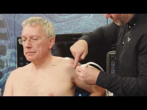 Ultrasound-Guided Shockwave for Frozen Shoulder | Osteopathic and Chiropractic CPD