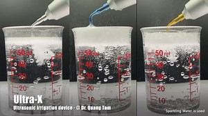 Ultra X Tips from Eighteeth 🔹X-Gold: Super Powerful 🔹X-Blue: Bendable 🔹X-Silver: Soft & Flexible | Eighteeth Medical