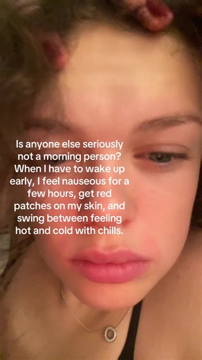 Struggling with Mornings? Understanding Morning Nausea