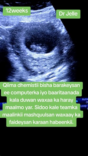 Qiima Dhemistii Bisha Barakeysan: Baaritaanada Computerka