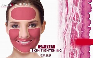 FOTONA 4D的四种操作规范